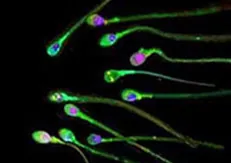 spermatozoid%5B1%5D.jpg