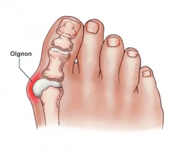 oignon.jpg