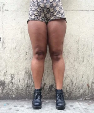 thigh_bare_1amsoa3-1amsoal.jpg