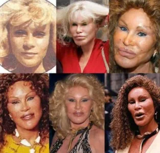 Jocelyn-Wildenstein-et-la-chirurgie-esthetique.jpg