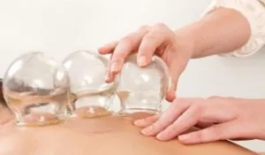 hijama.jpg
