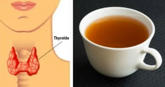 la-meilleure-facon-de-perdre-du-poids-si-vous-avez-un-trouble-de-la-thyroide.jpg