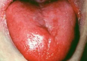 langue-rouge.jpg
