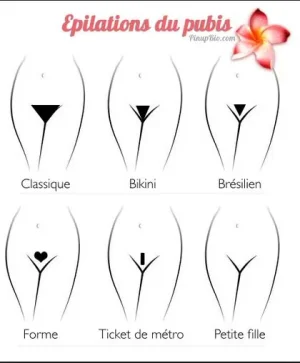 epilationpubis.JPG