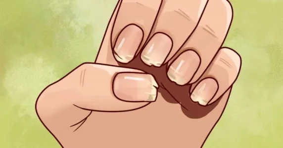 ongles-cassants-768x403.jpg