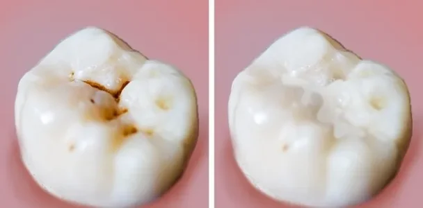 1. Nous n’apprenons pas à nos enfants à prendre soin de leurs dents.jpg