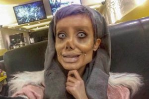Sahar-Tabar-l-Iranienne-qui-voulait-ressembler-a-Angelina-Jolie.jpg