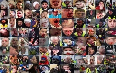 Blessures.de_.guerre.jpg