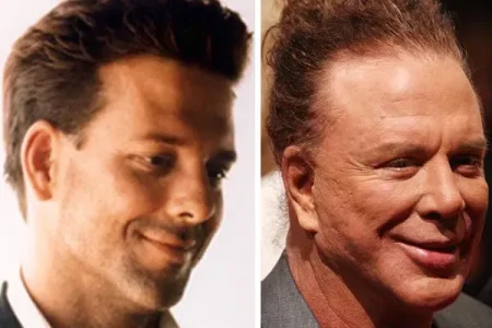 mickey-rourke-plastic-surgery.jpg