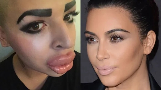 photos-un-fan-depense-190-000-euros-pour-ressembler-a-kim-kardashian-c-est-rate.jpg