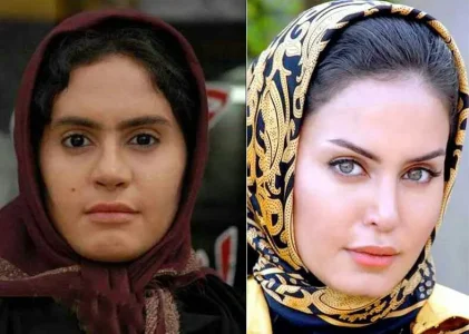 الناز-شاکر-دوست-قبل-از-عمل_2.jpg