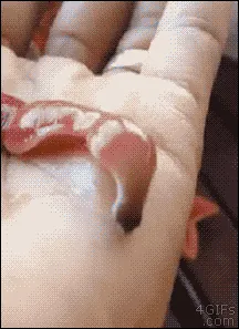 sangsue-degueu.gif