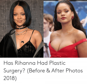 has-rihanna-had-plastic-surgery-before-after-photos-2018-53422904.png