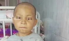 Enfants de la phénylcétonurie.jpg Enfants de la phénylcétonurie.jpg