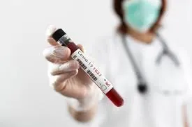 Test PCR.jpe