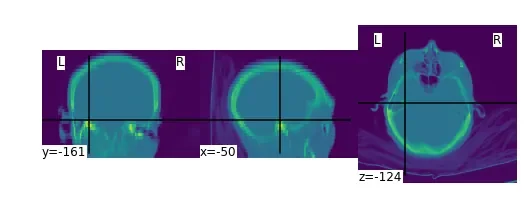 output_1_1.png