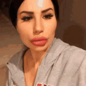 botox.gif