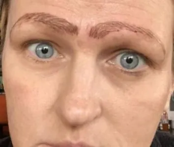 microblading-elle-se-retrouve-avec-4-sourcils-tatoues-sur-le-visage1.jpg