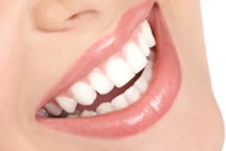 art-dents-blanchesf1219784610_0-858x572.jpg