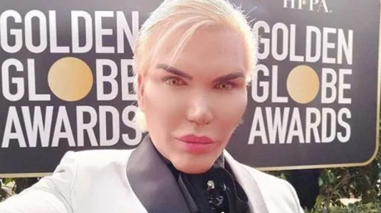rodrigo-alves-le-ken-humain-arrete-la-chirurgie-esthetique-continuer-mettrait-sa-vie-en-danger.jpg