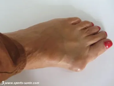 oignon-pied.jpg
