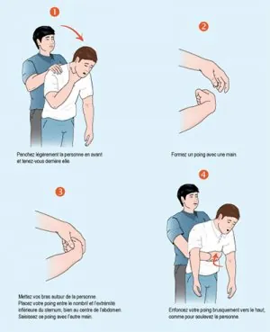 heimlich.jpg