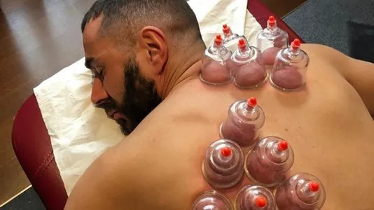 hijama.jpg hijama.jpg
