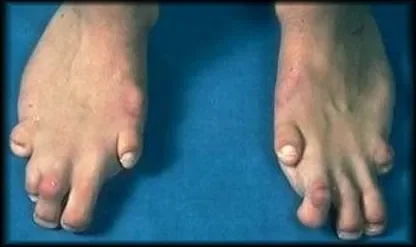 pieds.jpg