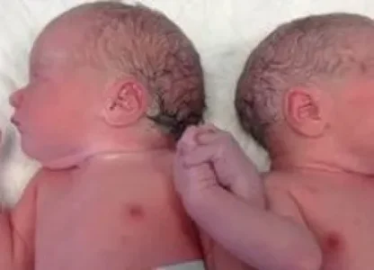 Des_jumeaux_qui_se_tiennent_la_main_a_la_naissance_mettent_le_web_en_emoi_1.jpg