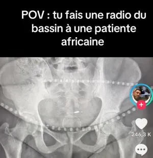 Screenshot_20250403_004321_TikTok.jpg