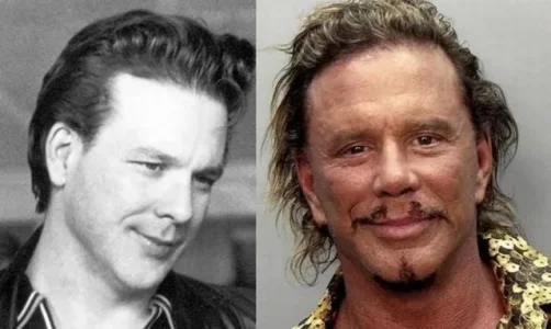 Mickey-Rourke-avant-apres.jpg