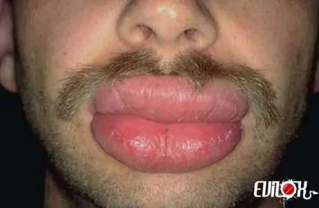 bouche.jpg