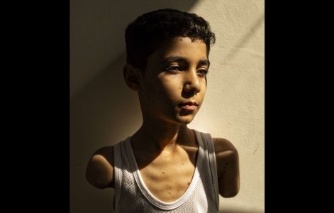 1444x920_mahmoud-ajour-9-years-old-lost-both-hands-after-being-hit-by-a-missile-from-israeli-...jpeg