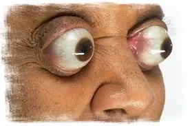 yeux horribles.jpg