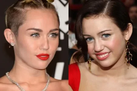 ENT-Celeb-Surgery-Miley-Cyrus.jpg