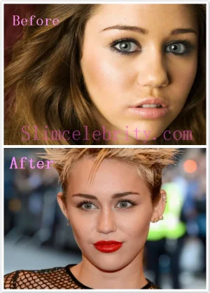 miley_cyrus_plastic-surgery-before-and-after-photos-nose-job-3.jpg