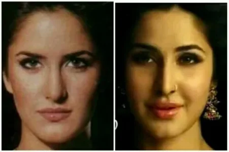 katrina_kaif_plastic-surgery.jpg