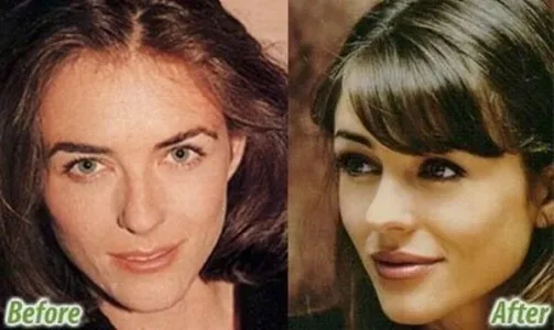 stars_before_after_plastic_surgery_39.jpg