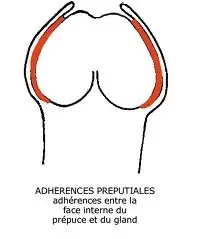adherence.jpeg