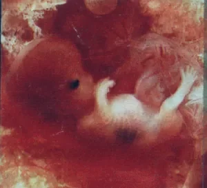 foetus_2mois_1_-2513e.png